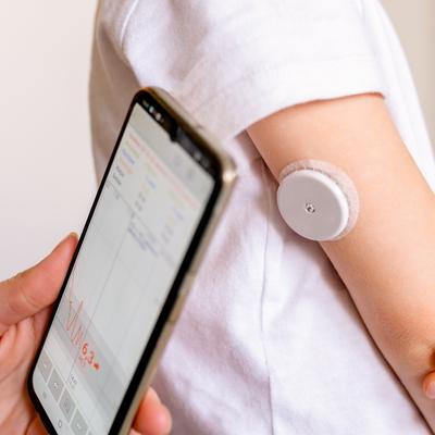 Continuous Glucose Monitoring