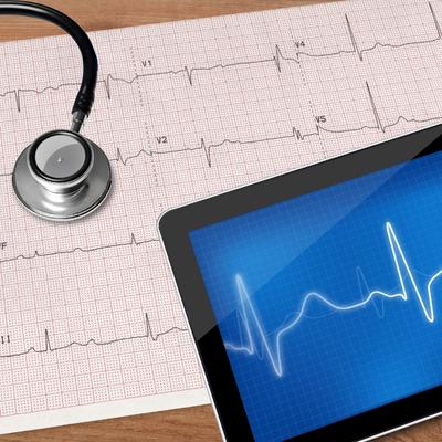 Stress Electrocardiogram